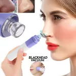 Blackhead Vacuum Suction Mini Facial Pore Spot Cleaner Face Dirt Suck Up Acne Remover Beauty Skin Care Tool