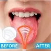 Tongue Scraper Tongue Cleaner Brush Zaban Cleaner Toothbrush Mouth Fresher Dental Care Brush Bad Breath Oral Fresher For Fresh Breath