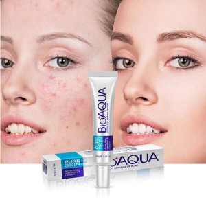 100% Original BIO AQUA Anti Acne Remover & Rejuvenation Cream - For Men and Women