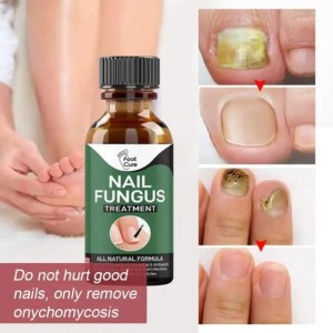 Fast Nail Fungal Treatments Nail Repair Essences Serum Care Treatments Foot Nail Fungus Removal Gel Paronychia Onychomycosis